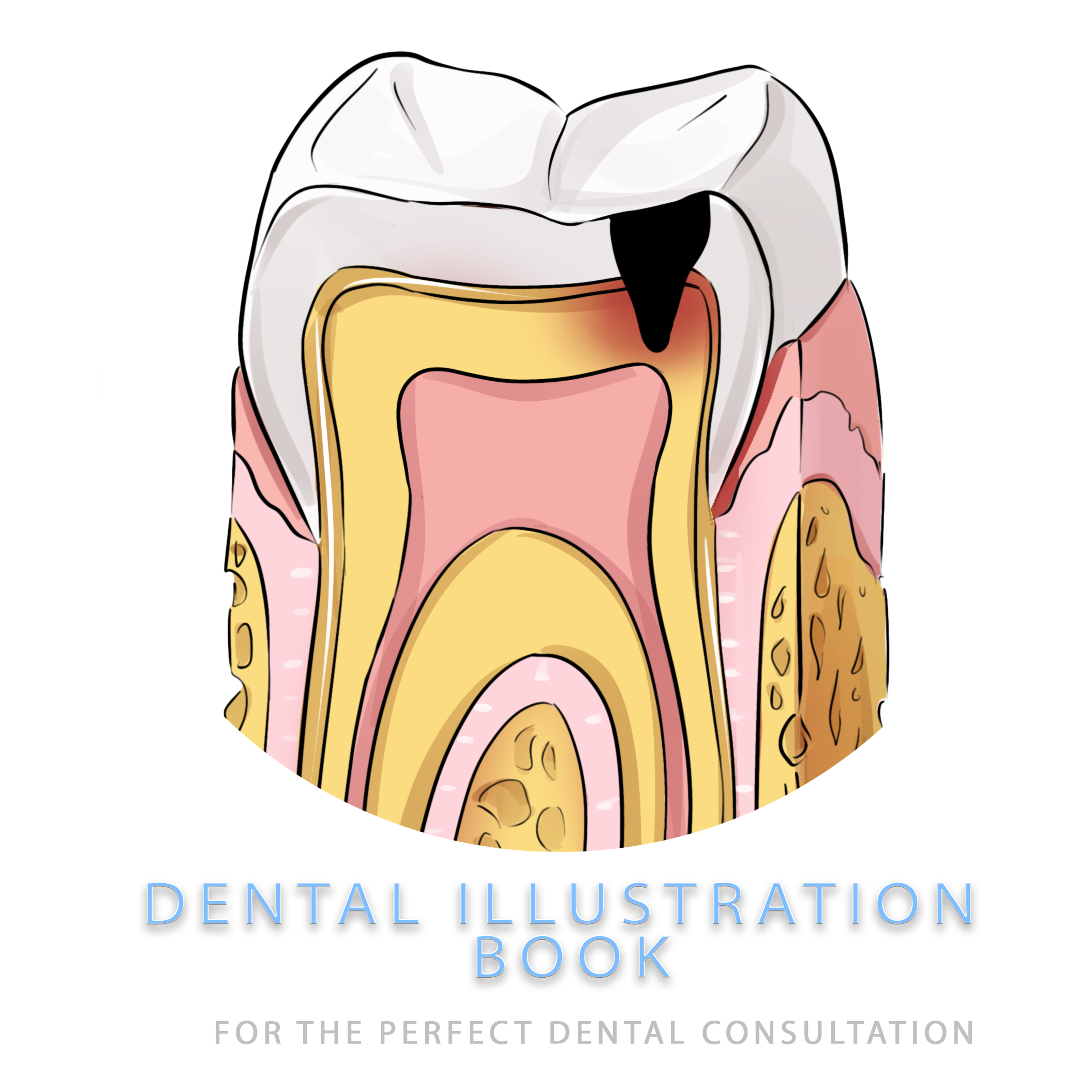 Dental-Illustration